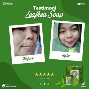 Testimoni Leafhea